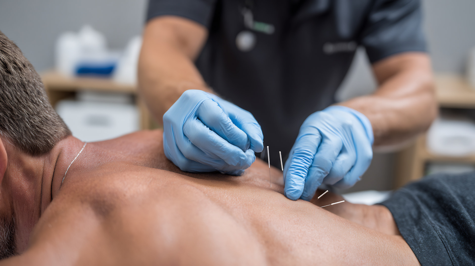 Dry Needling for Chronic Muscle Pain: What to Expect