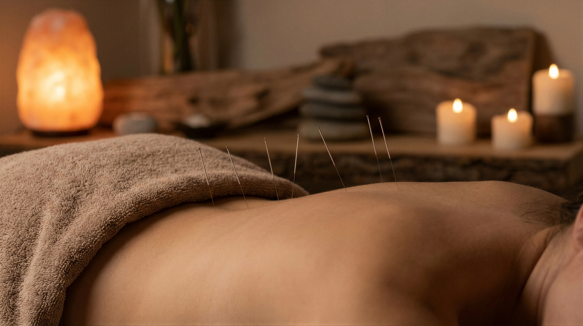 Acupuncture treatment with thin needles